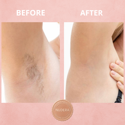 Nudera™ Cyperus Rotundus Oil